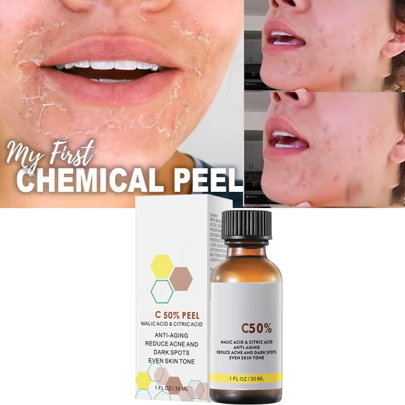 Salicylic Acid Cleanser - ด้วย Malic Acid และกรดซิตริกสําหรับ Face Facial