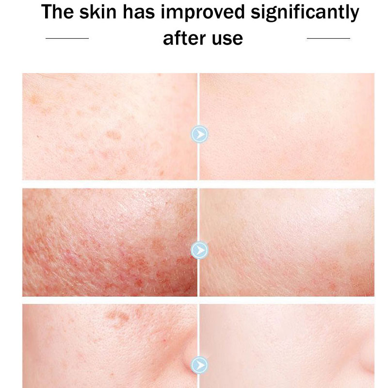 Original Queen ยี่ห้อครีม PZH  - Skincare Queen บทวิจารณ์และราคา