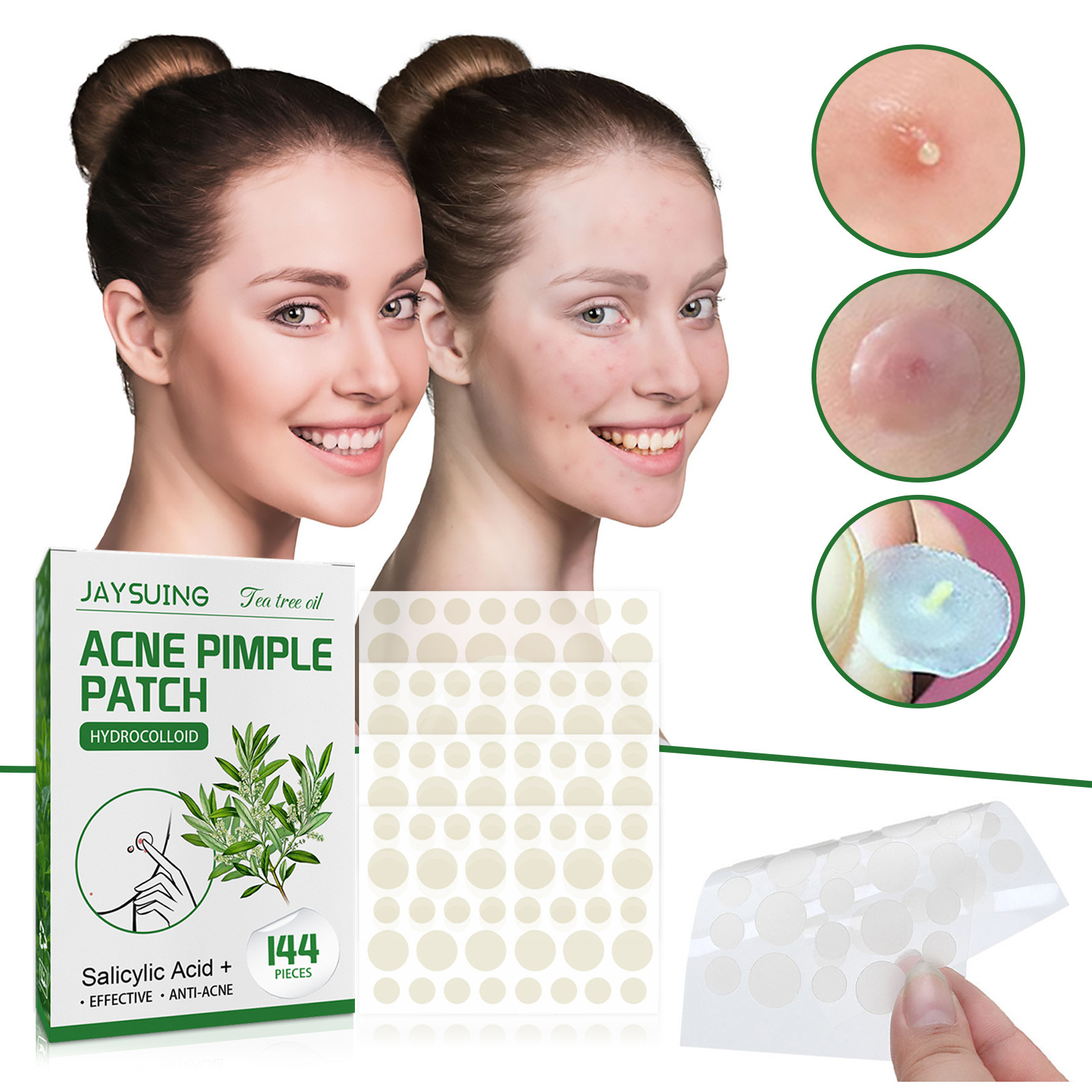 แผ่นแปะสิวไฮโดรคอลลอยด์ - ดูดซ - Hydrocolloid Acne Patch บทวิจารณ์และราคา